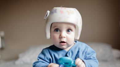 pourquoi les bebe ont la tete plate