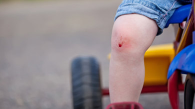 L Enfant Qui A Fait Une Chute