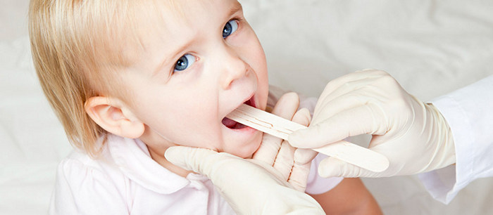 Throat infections: pharyngitis, tonsillitis, and streptococcus